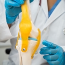 Osteoarthritis,Of,The,Knee,,Doctor,Holding,Human,Knee,Joint,Orthopedic