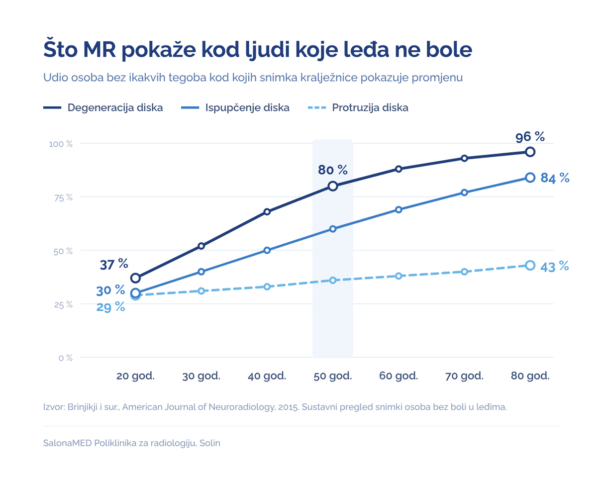 Alt tekst: Udio osoba bez boli u leđima kod kojih MR pokazuje degeneraciju, ispupčenje ili protruziju diska, od 20. do 80. godine